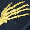 Le pubis : anatomie complète, rôle et pathologies du pelvis