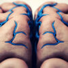 Le sinus sagittal supérieur : anatomie, fonction et pathologies