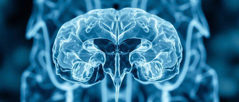 Le Troisième Ventricule : Anatomie, Fonctions et Pathologies