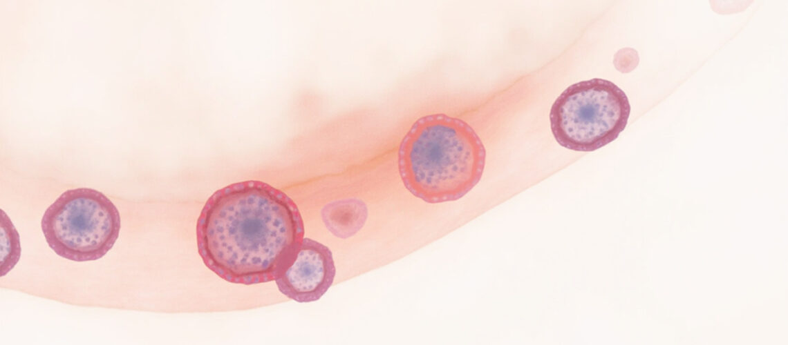Leishmaniose viscérale : causes, symptômes, diagnostic et traitement