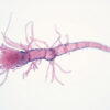 Leptospira interrogans : la bactérie responsable de la leptospirose