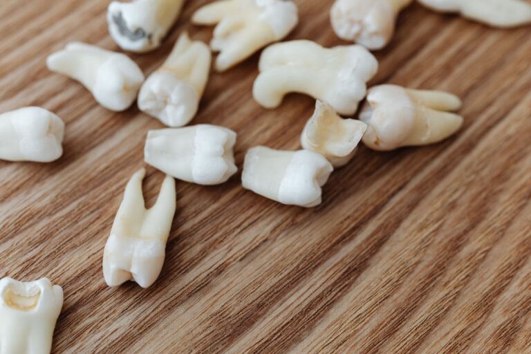 Les dents molaires : anatomie, rôle et soins essentiels