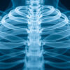 Les muscles subcostaux : anatomie, fonction et importance clinique