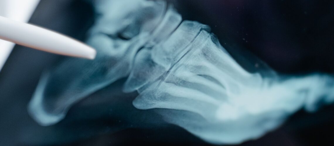 Detailed close-up of a foot x-ray displayed on a digital tablet screen.