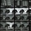 High-resolution radiological images showcasing the complex structure of the human spine for medical examination.
