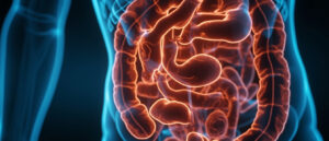 Mégacôlon : causes, symptômes, diagnostic et traitements