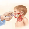 Micropénis : Causes, Diagnostic et Prise en Charge