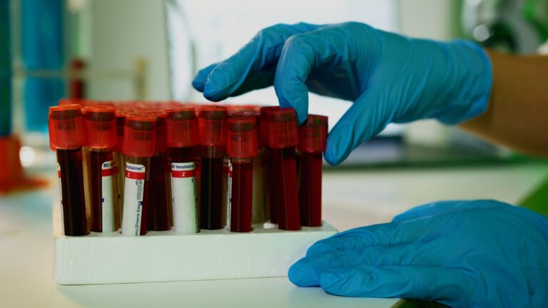 Neutropénie fébrile : causes, symptômes, traitement et prévention
