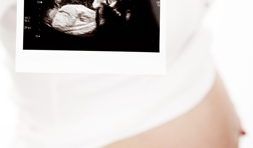 Oligoamnios : comprendre, diagnostiquer et gérer le manque de liquide amniotique