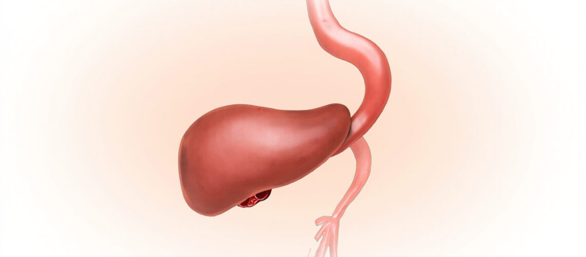 Pancréatite chronique : causes, symptômes, diagnostic et traitement