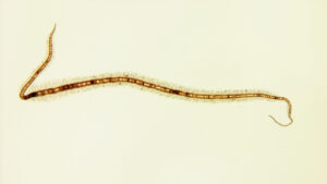 Paracoccidioides brasiliensis : comprendre cette mycose d'Amérique latine