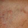 Detailed close-up image highlighting the texture and wrinkles of aging human skin.
