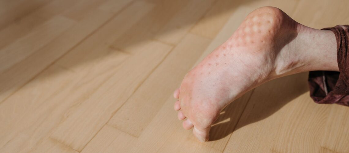 A detailed close-up of a human foot resting on a wooden floor indoors.