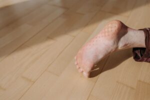 Pied creux : causes, symptômes, diagnostic et traitements
