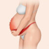 Placenta accreta : comprendre cette complication grave de la grossesse