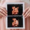 Close-up of a pregnant woman holding an ultrasound printout, symbolizing anticipation and maternity care.