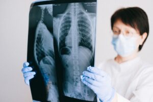 Pneumopathie organisée : causes, symptômes, diagnostic et traitement