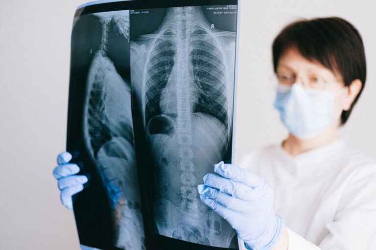 Pneumopathie organisée : causes, symptômes, diagnostic et traitement