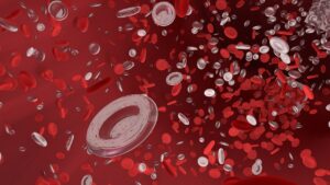 Polyglobulie de Vaquez : symptômes, diagnostic et traitements