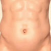 Région ombilicale : anatomie, structures et pathologies associées