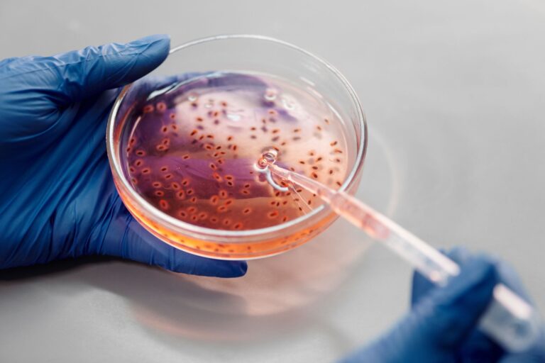 Salmonella Dublin : tout savoir sur cette bactérie invasive
