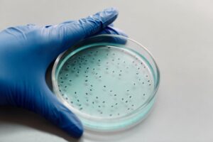 Salmonella Typhimurium : tout comprendre sur cette bactérie pathogène