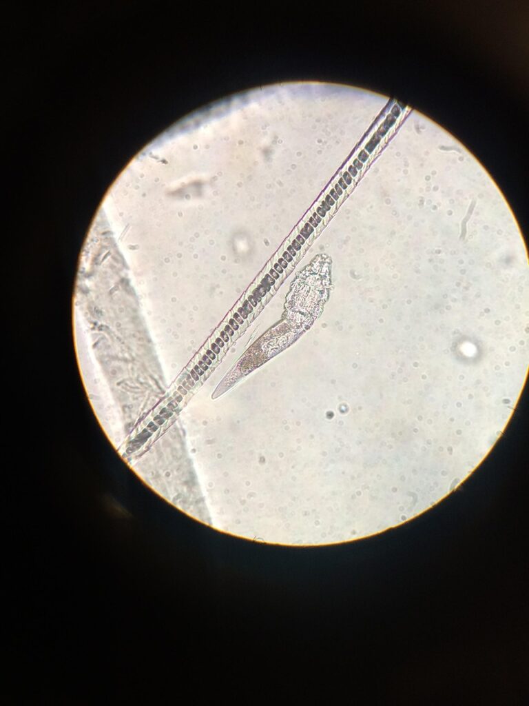 Schistosoma mansoni : comprendre la bilharziose intestinale