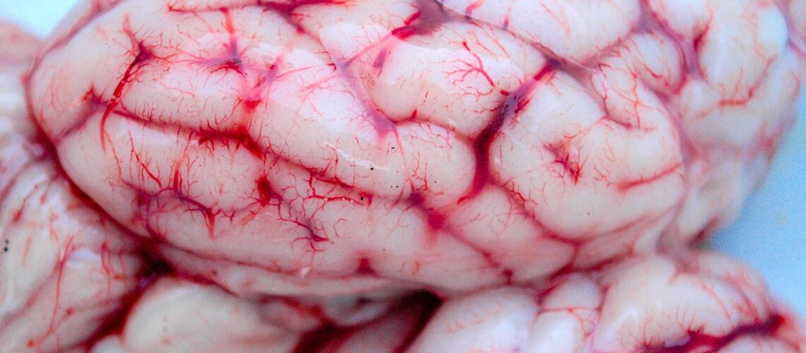 Scissure de Sylvius : Anatomie, Fonctions et Importance Clinique