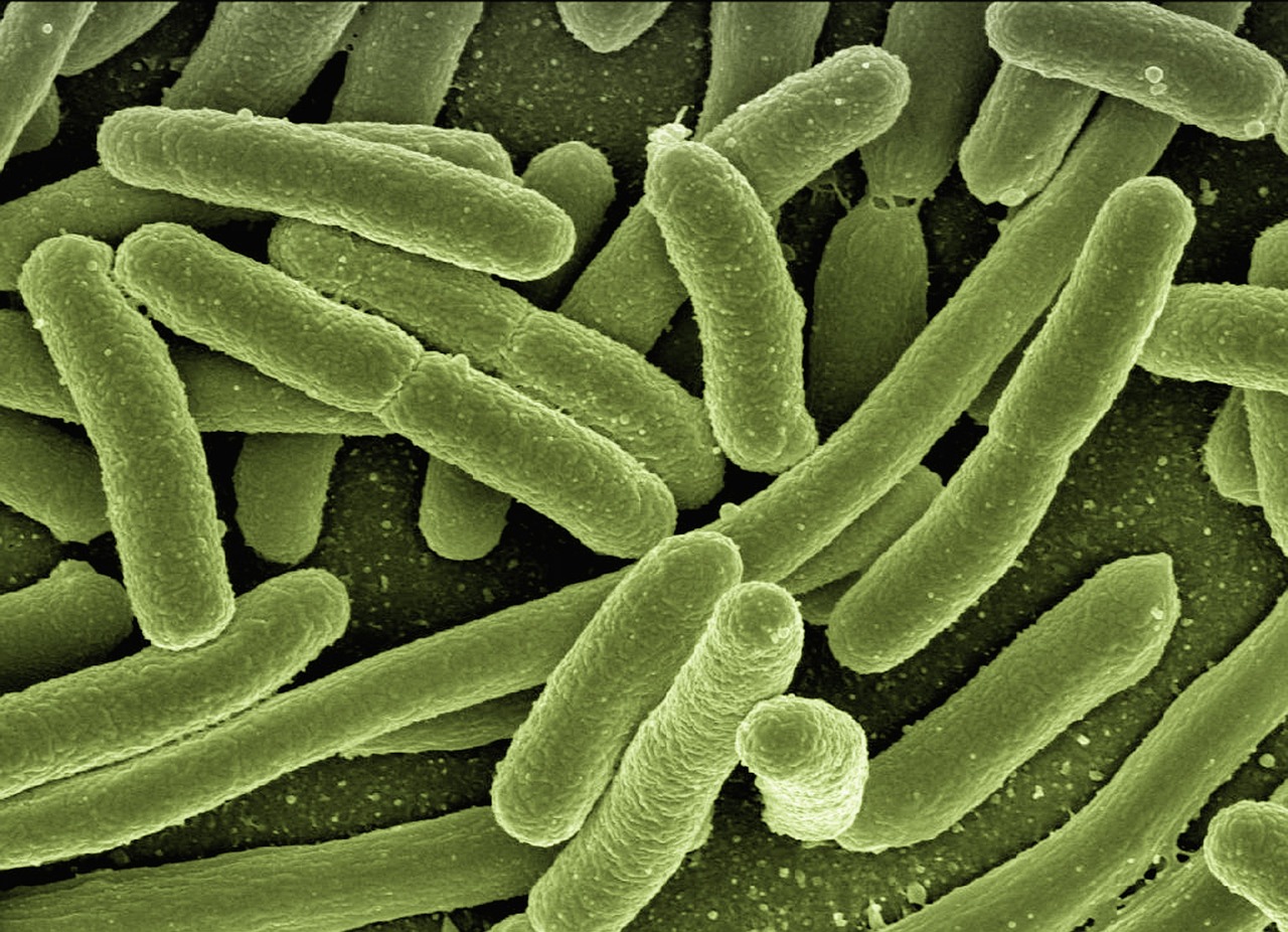 Shigella sonnei : causes, symptômes, traitement et prévention de la shigellose