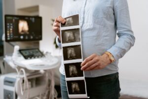 Souffrance fœtale : causes, diagnostic et prise en charge