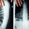 An illustrative close-up of a spine X-ray with hands, highlighting medical imaging and anatomy.