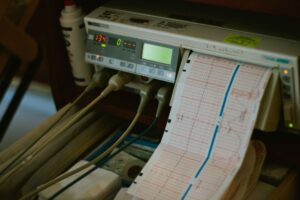 Tachycardie supraventriculaire : comprendre, reconnaître et traiter ce trouble du rythme cardiaque
