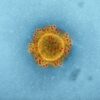 High-resolution image of coronavirus particle under electron microscope.
