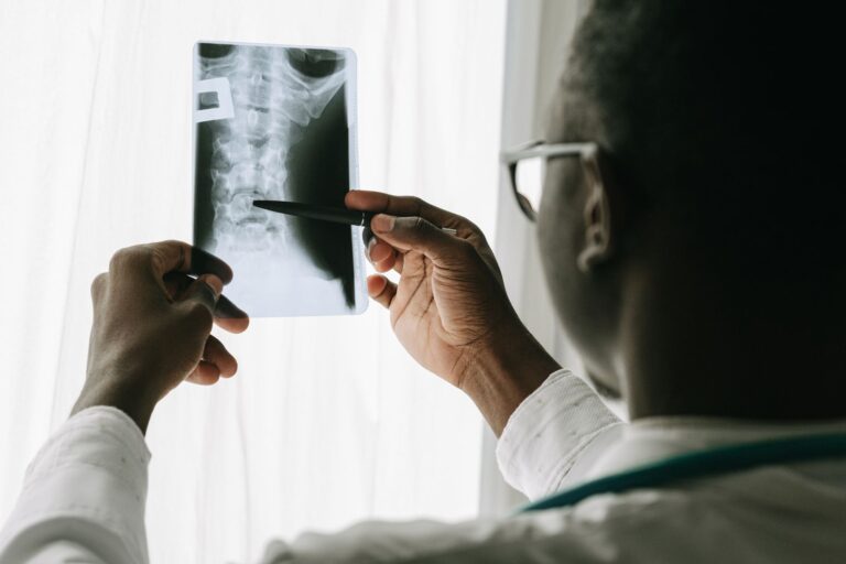Tuberculose osseuse : causes, symptômes, diagnostic et traitement