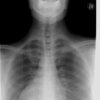 Vertèbre thoracique : anatomie complète, fonctions et pathologies