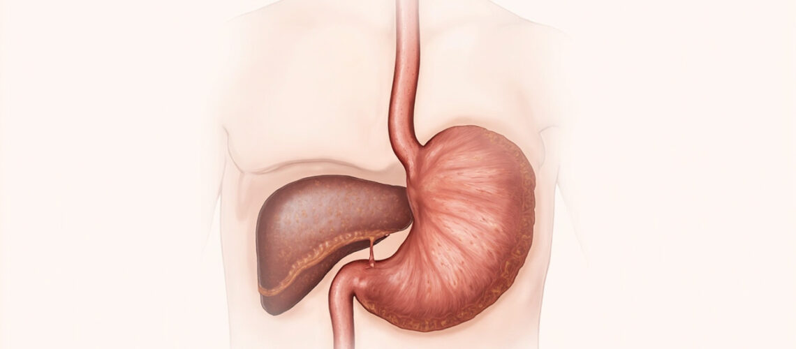 VIPome : comprendre cette tumeur neuroendocrine rare