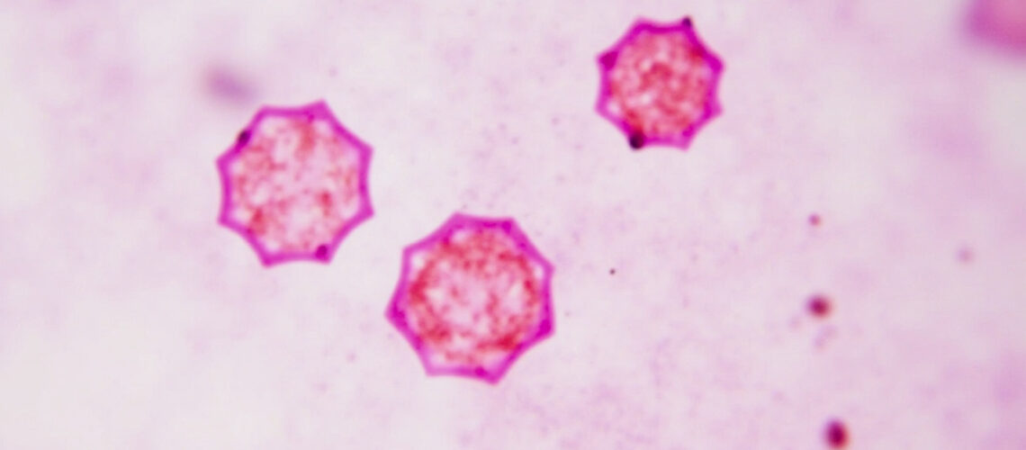 Virus Lujo : tout savoir sur ce pathogène émergent responsable de fièvres hémorragiques