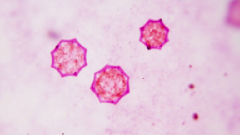 Virus Lujo : tout savoir sur ce pathogène émergent responsable de fièvres hémorragiques
