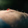Macro shot of a mosquito biting human skin, illustrating pest behavior and disease risk.