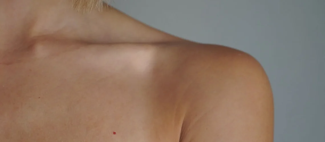 Vue détaillée de l'épaule et du teint d'une femme sous un éclairage naturel.