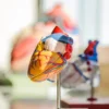 Cardiomyopathie restrictive : comprendre cette maladie rare du muscle cardiaque