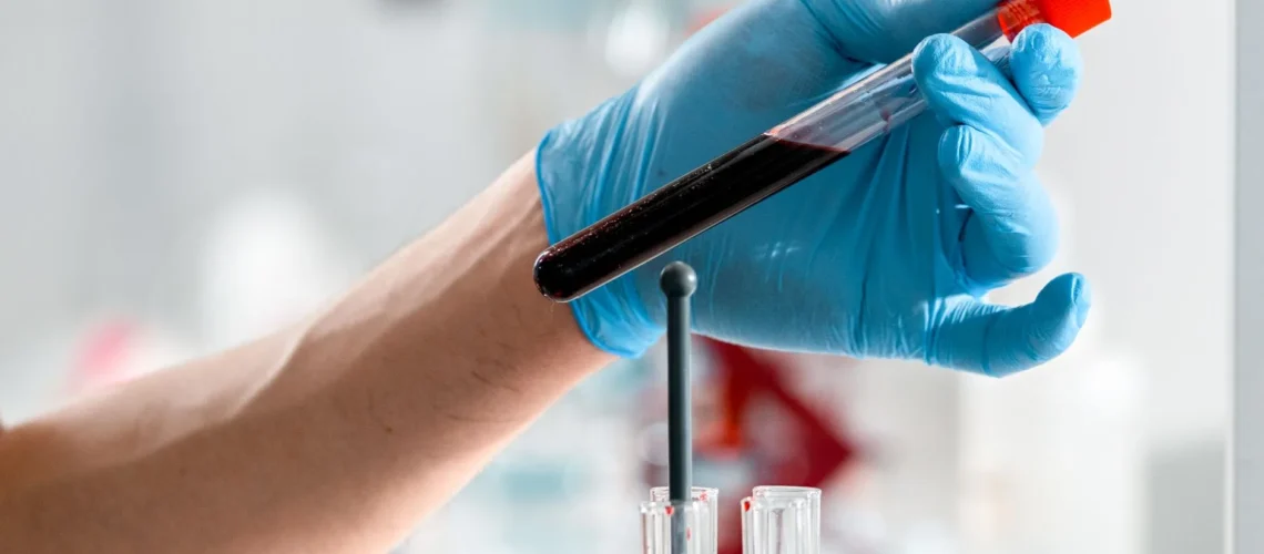 Main gantée tenant un tube à essai avec un échantillon de sang dans un laboratoire de recherche clinique.
