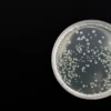 Corynebacterium diphtheriae : la bactérie responsable de la diphtérie