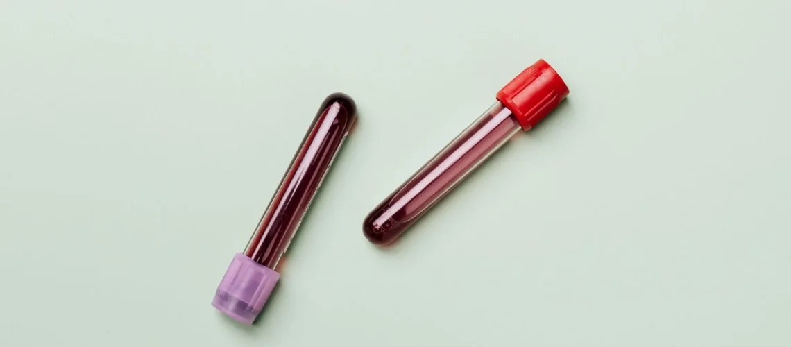 Échantillons de sang dans des tubes à essai sur fond clair, pour thèmes médicaux et de laboratoire.