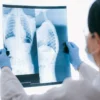 Professionnel de santé analysant des radiographies pulmonaires en milieu clinique à des fins diagnostiques.