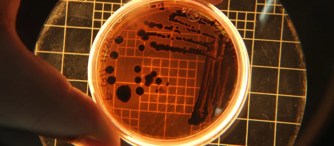 Gros plan de colonies bactériennes dans une boîte de Petri sous un microscope dans un laboratoire
