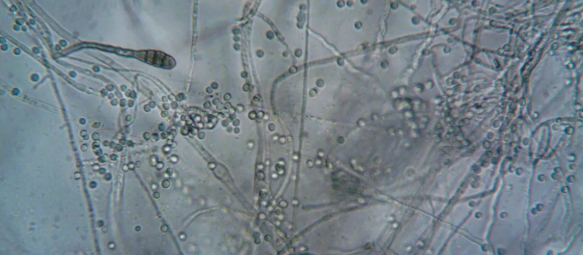 Vue microscopique détaillée montrant des hyphes fongiques et des spores, idéale pour la biologie et la microbiologie.
