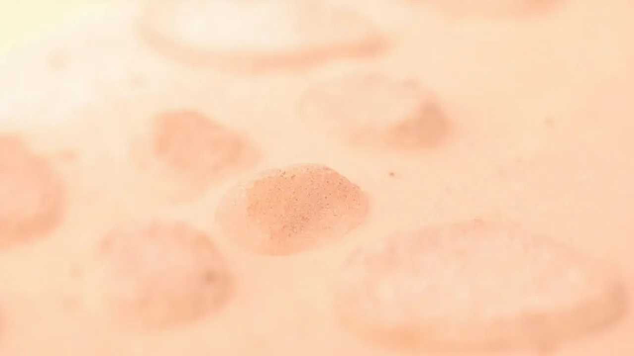 Kératose actinique : causes, symptômes et traitements