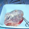 La chaîne sympathique : anatomie, fonction et pathologies