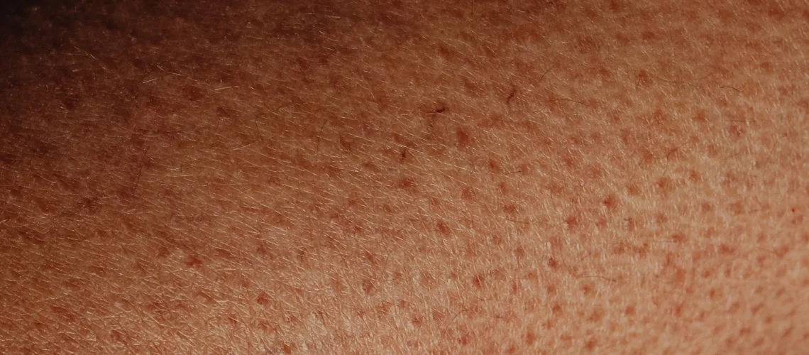Vue rapprochée détaillée de la surface de la peau humaine montrant la texture naturelle et les imperfections.